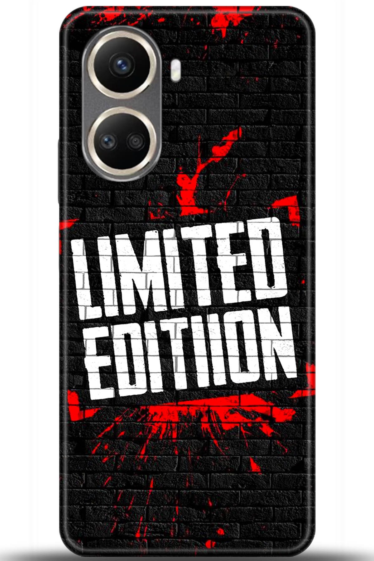 Huawei Nova 10 Uyumlu Kılıf HD Baskılı Kılıf - Followed Institution 5454