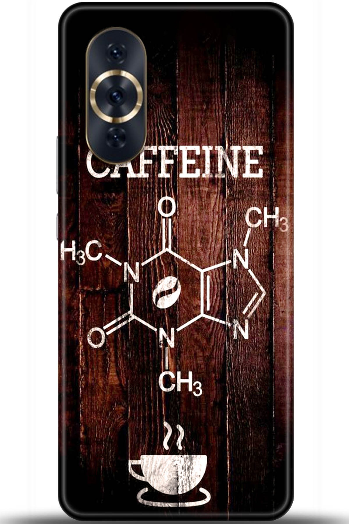 Huawei Nova 10 Pro Uyumlu Kılıf HD Baskılı Kılıf - Followed Institution 5501