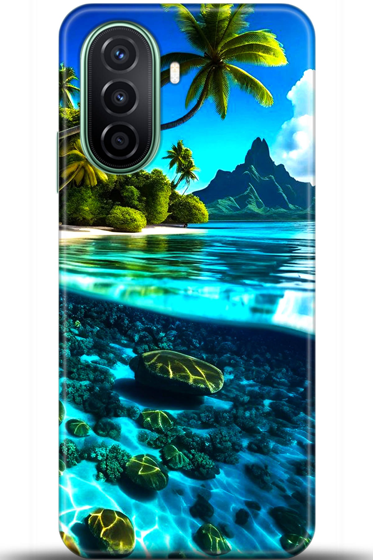 Huawei Nova Y70 Uyumlu Kılıf HD Baskılı Kılıf - Followed Institution 5491