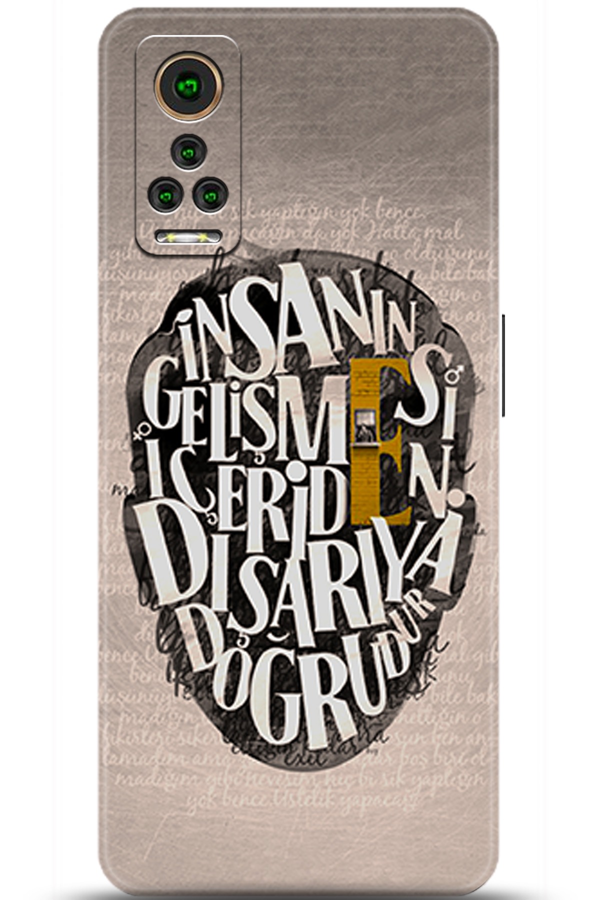 General Mobile GM 22 Pro Uyumlu Kılıf HD Baskılı Kılıf - Followed Institution 5587