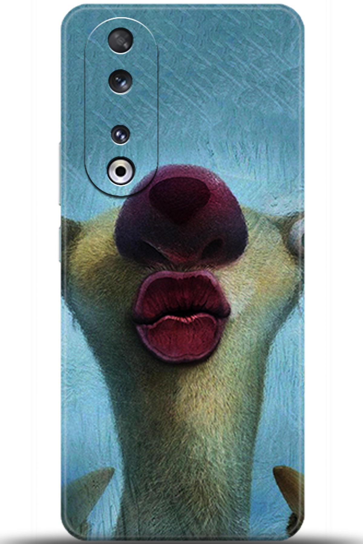 Honor 90 Uyumlu Kılıf HD Baskılı Kılıf - Followed Institution 5372